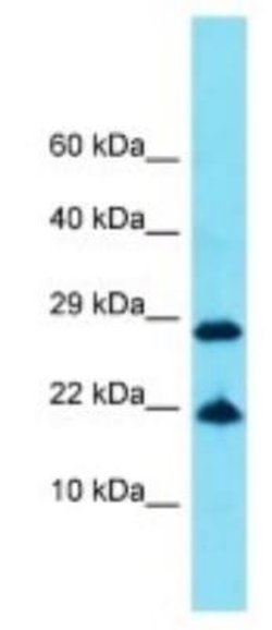 FAM25E Rabbit anti-Human, Polyclonal, Novus Biologicals:Antibodies:Primary